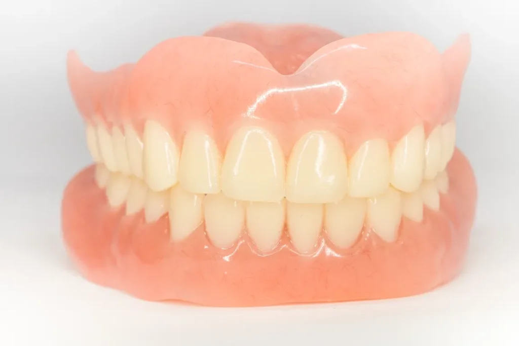 Custom-made full dentures designed to resemble natural teeth and gums, restoring comfort and confidence at Pearl Dental.