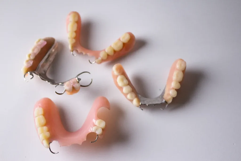 Removable partial dentures with metal clasps used to replace several missing teeth and blend with natural ones at Pearl Dental.